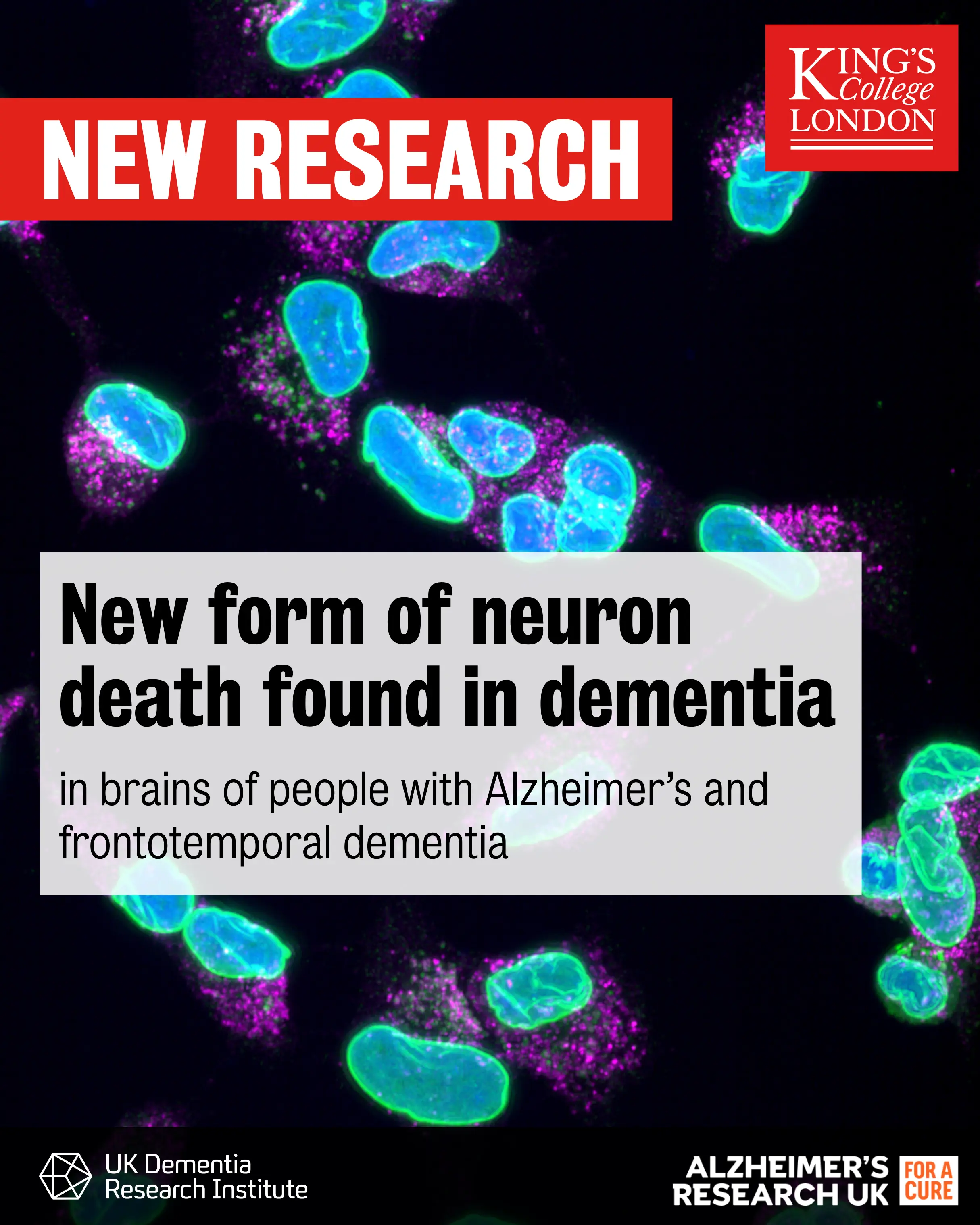New mechanism found for neuronal death in Alzheimer's and frontotemporal dementia